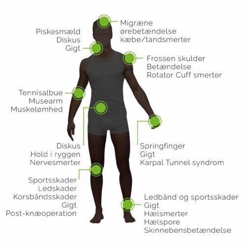 Fysiovejen Gigalaser